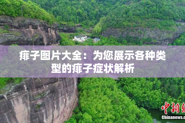痱子图片大全：为您展示各种类型的痱子症状解析