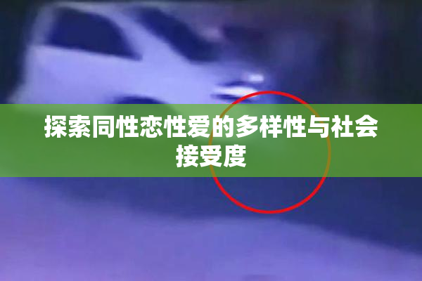 探索同性恋性爱的多样性与社会接受度
