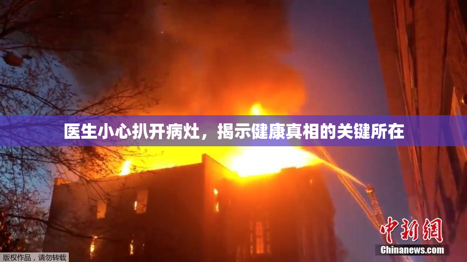 医生小心扒开病灶，揭示健康真相的关键所在