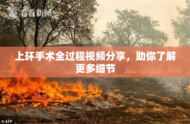 上环手术全过程视频分享，助你了解更多细节