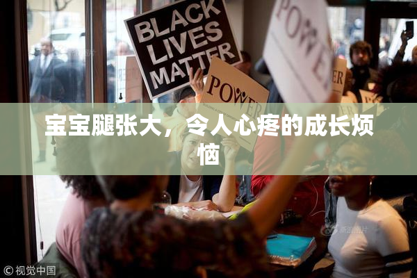 宝宝腿张大，令人心疼的成长烦恼