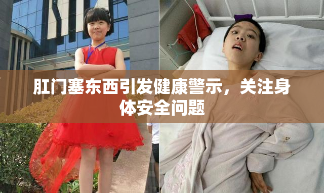 肛门塞东西引发健康警示，关注身体安全问题