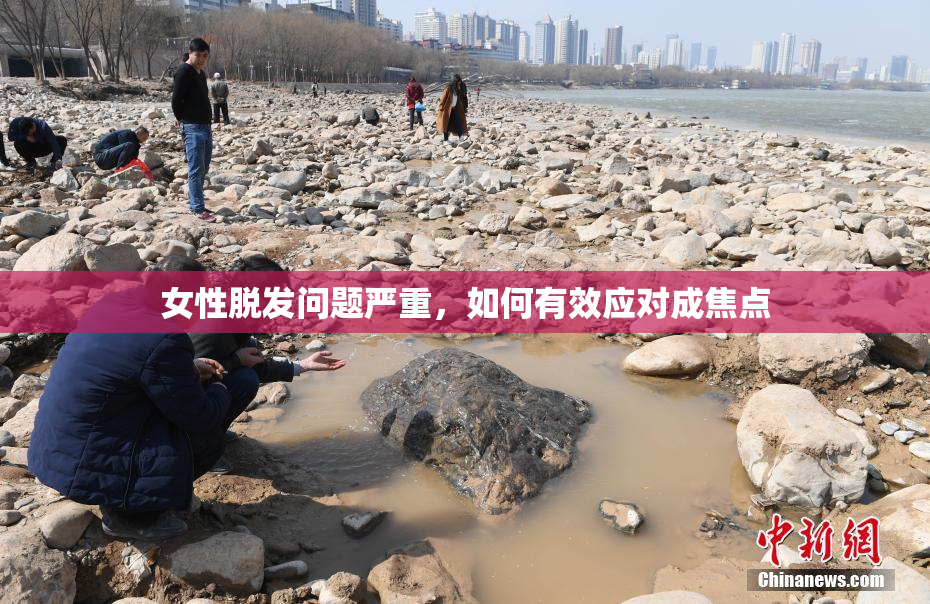 女性脱发问题严重，如何有效应对成焦点