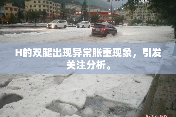H的双腿出现异常胀重现象，引发关注分析。