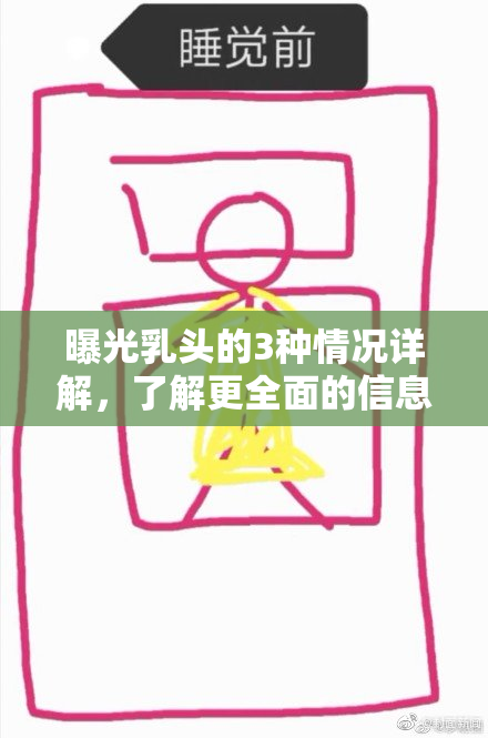 曝光乳头的3种情况详解，了解更全面的信息