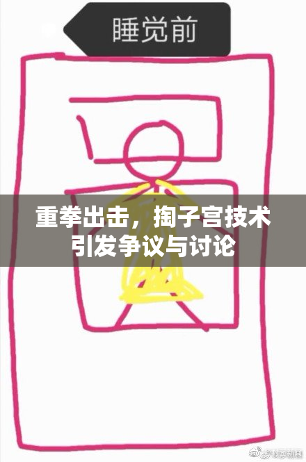 重拳出击，掏子宫技术引发争议与讨论