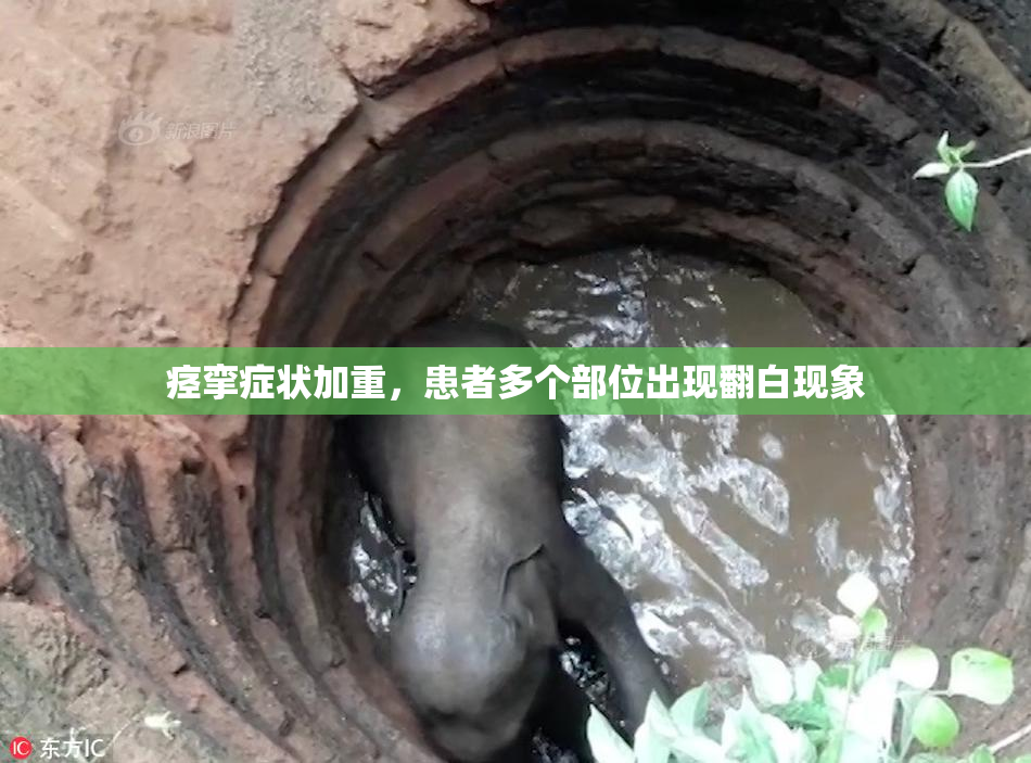 痉挛症状加重，患者多个部位出现翻白现象