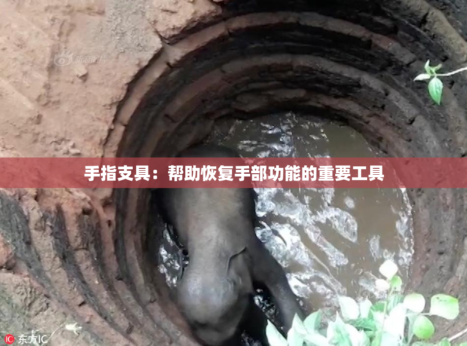 手指支具：帮助恢复手部功能的重要工具